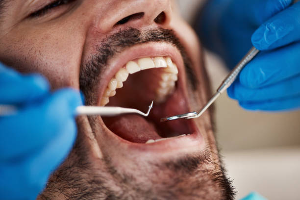 Best Knocked-Out Tooth Emergency  in Sparta, IL